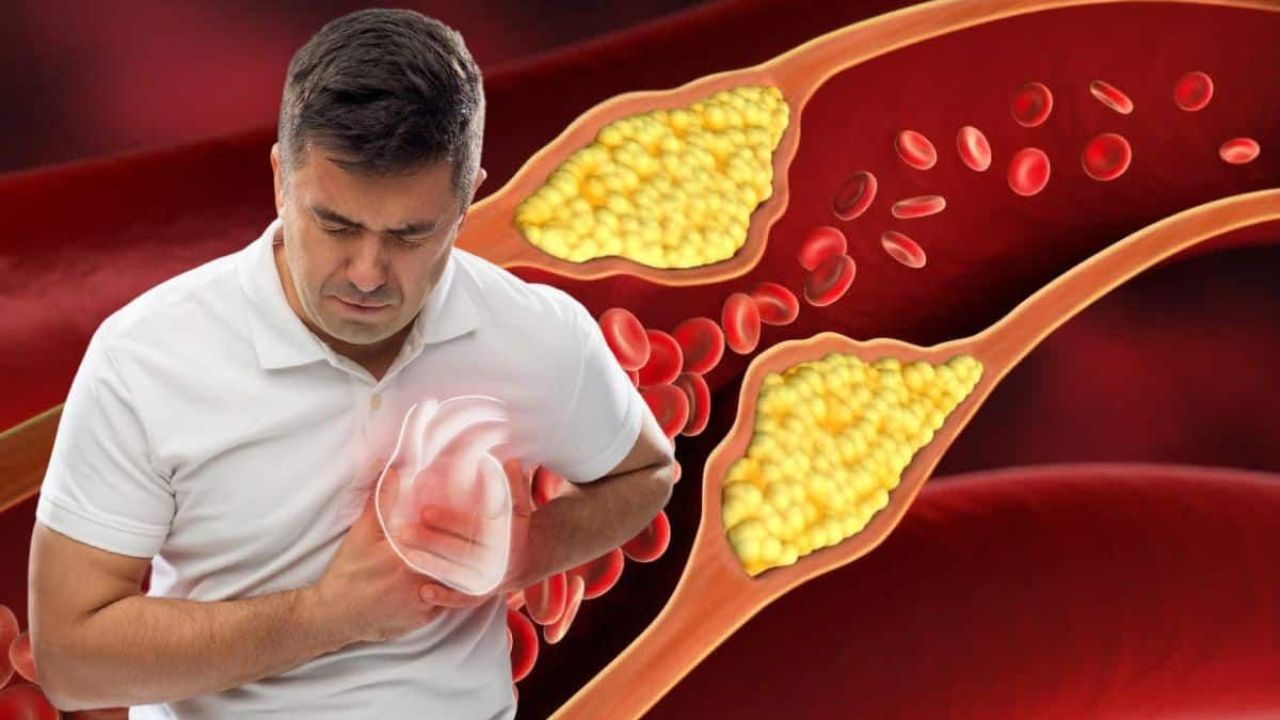 First Symptoms of Artery Blockage You Shouldn’t Ignore