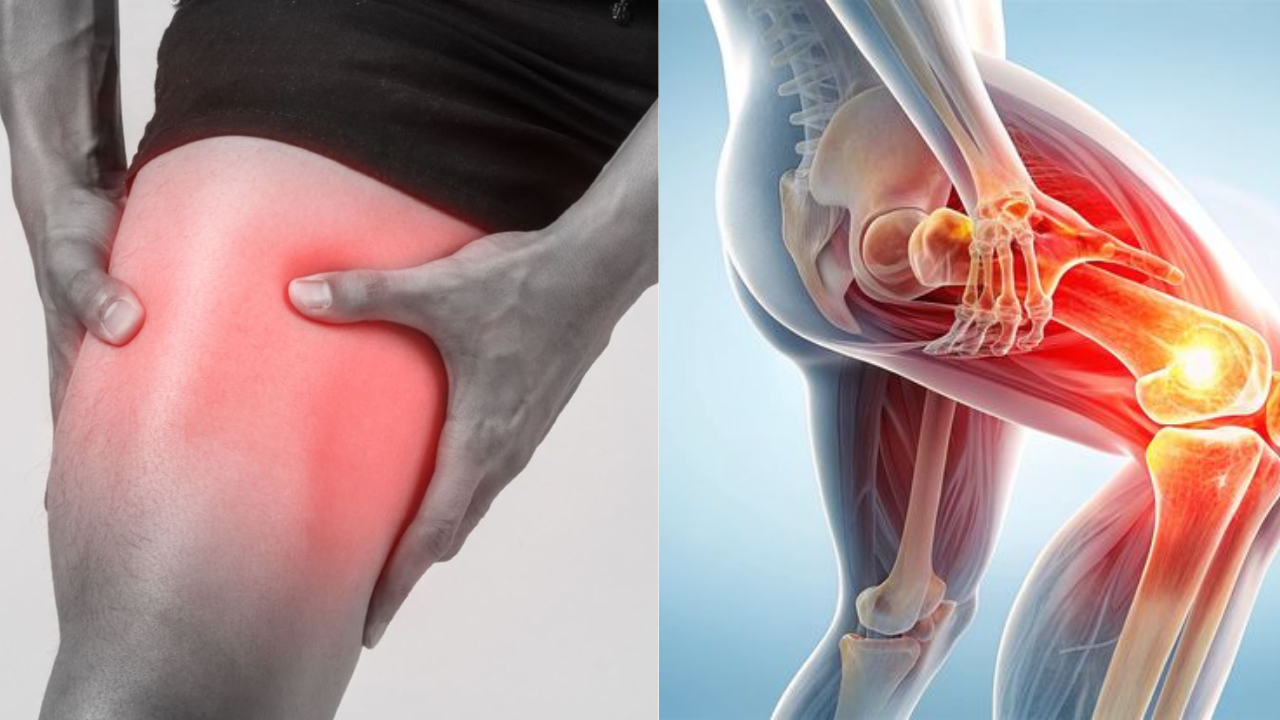 Thigh and Leg Pain? It’s Not a Vitamin Deficiency—Here’s the Real Cause