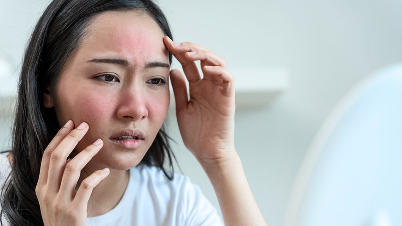 Don’t Ignore Fatigue & Joint Pain – Could These Be Lupus Signs?