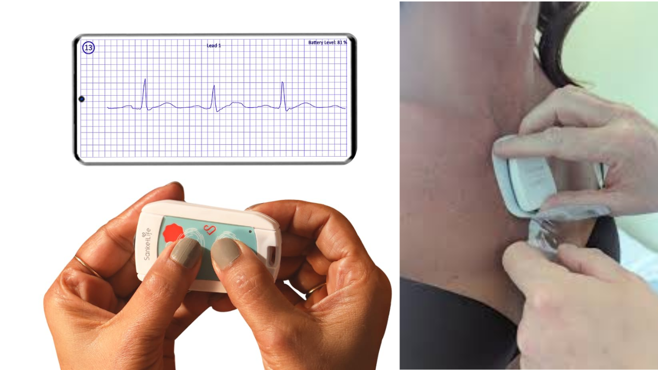 Matchbox-Sized Device Sends ECG Report to Mobile in Just 2 Minutes!