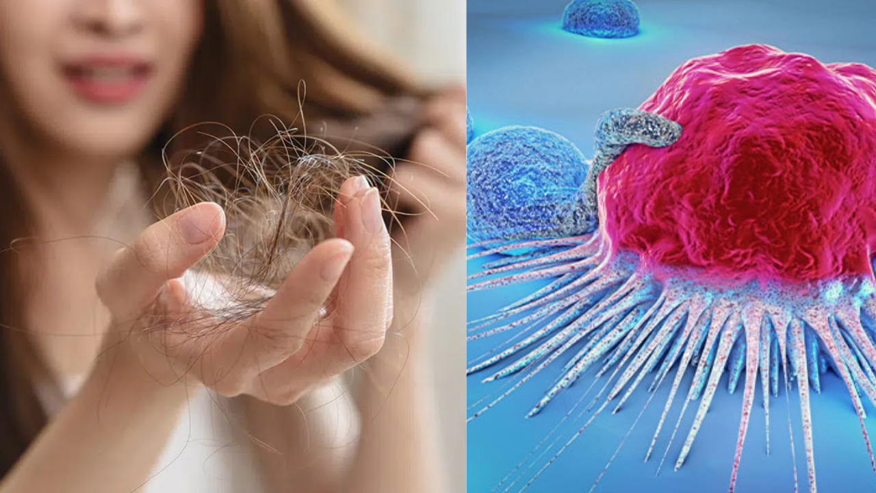 Does Hair Fall Indicate Cancer? Experts Reveal the Facts