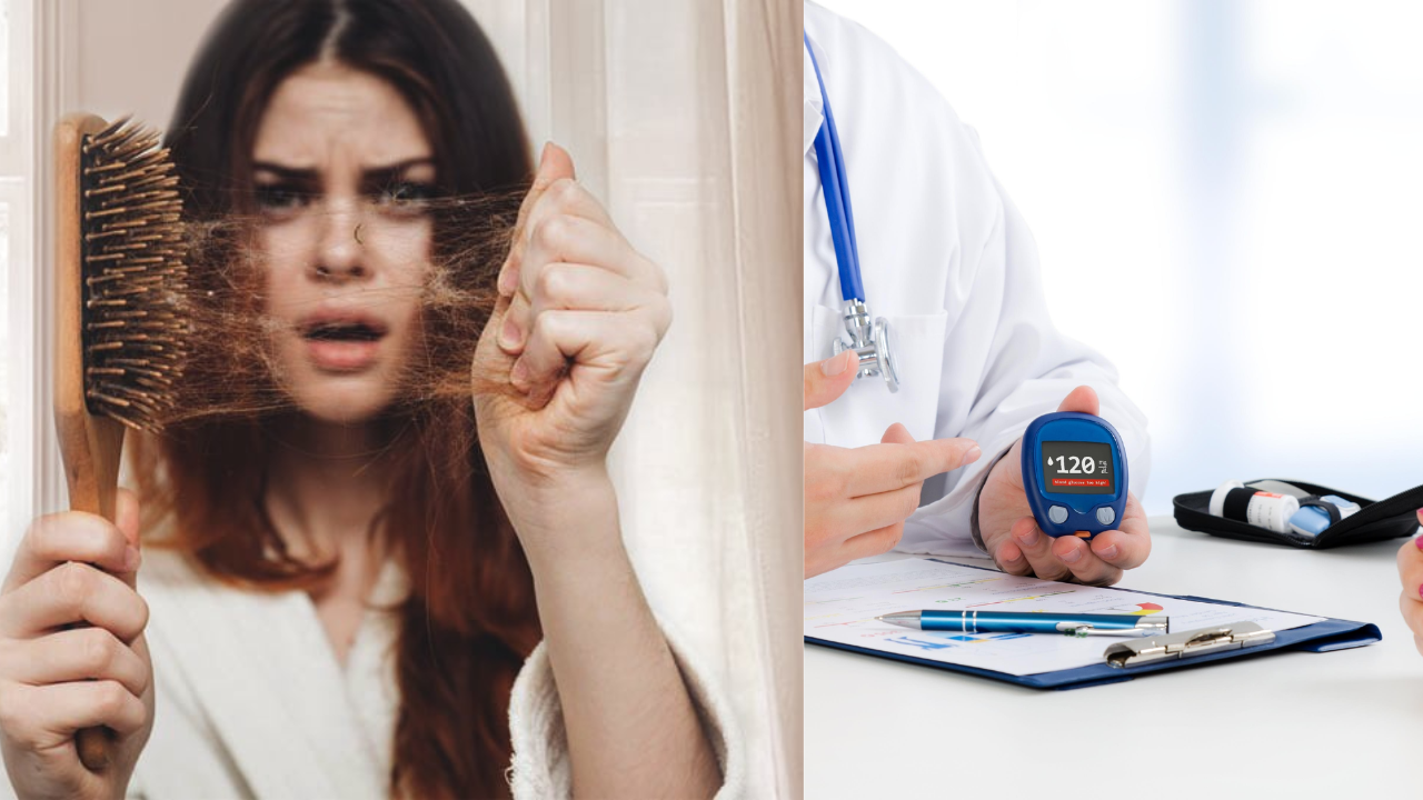 Hair Loss and Diabetes: Experts Explain the Hidden Connection