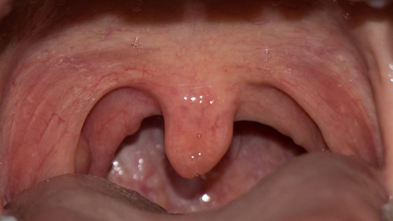 Simple and Effective Tips to Relieve a Sore Tongue