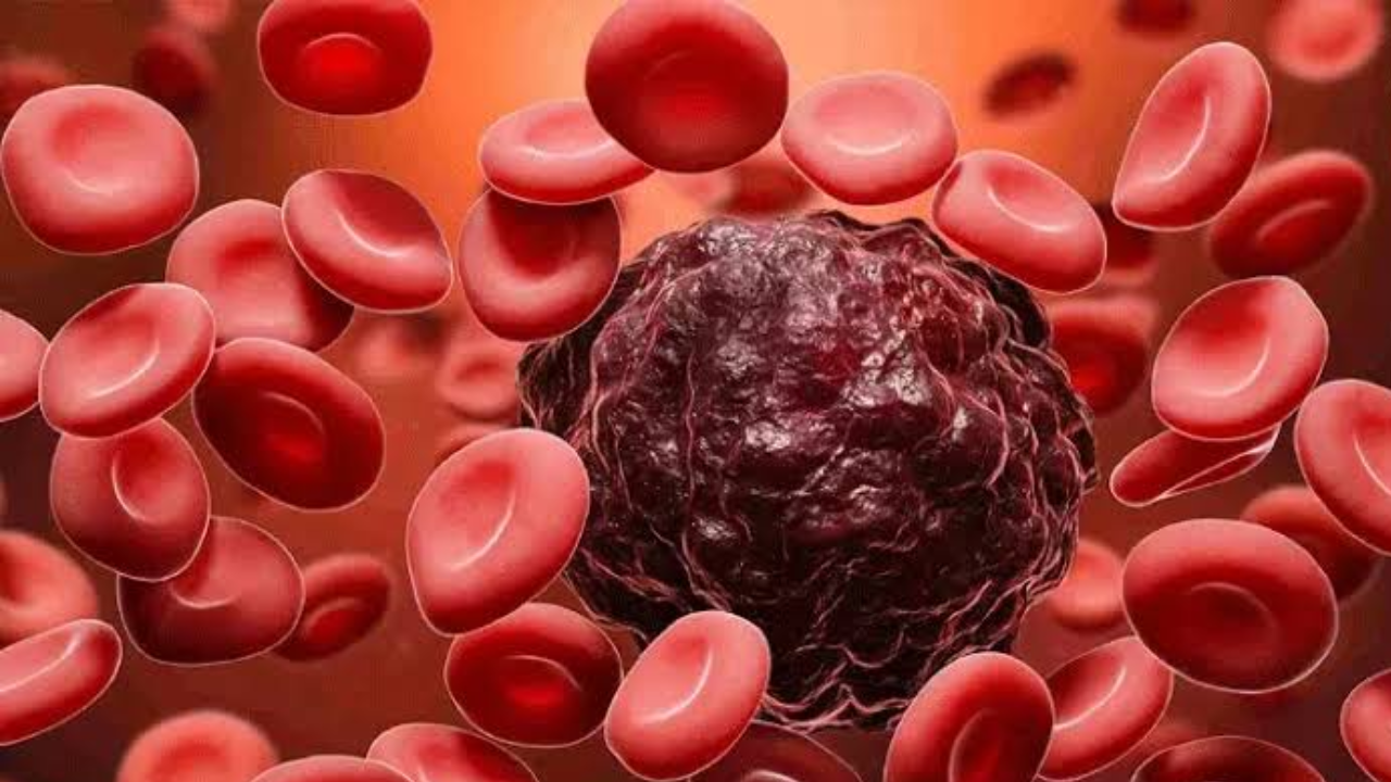 WHO Warns: Cases Could Rise Dramatically by 2050